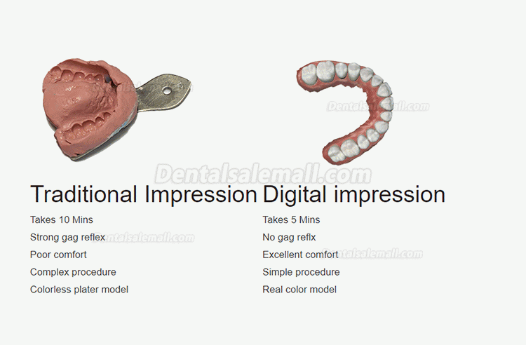 Fussen S6000 Portable Dental 3D Digital Intraoral Scanner Color Scanning 3D