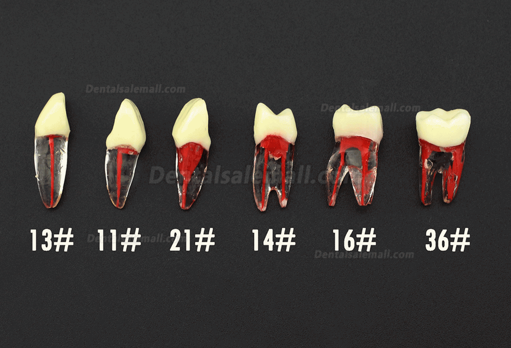 Dental RCT Endo Practise Typodont Teeth Naturally Rooted Compatible with Kilgore Nissin