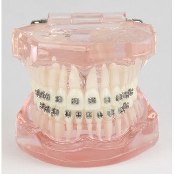 Dental Teeth Malocclusion Correct With Metal Bracket Standard Model M3001