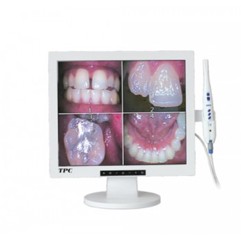 TPC Dental Wired Intraoral Camera AIC5855A with 17