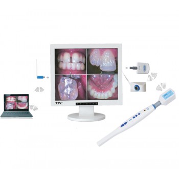 TPC Dental Cordless Intraoral Camera AIC5855A with 17