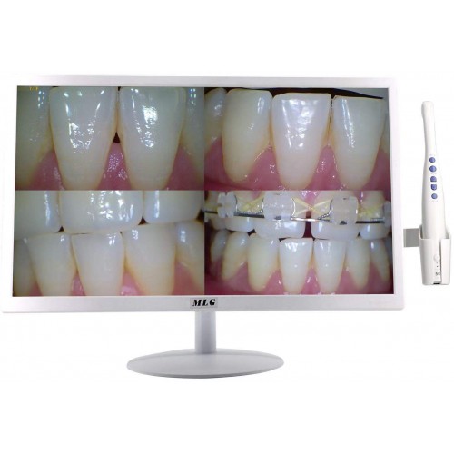 MLG M-978A 19 Inch LCD Monitor with 5G Wireless Wifi 8 Mega Pixels Intraoral Camera for Dental Chair