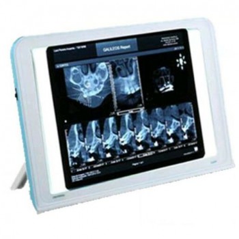 HISHINE® Dental Luna X-ray Film Reader LED Specific Wall Desk Mounting