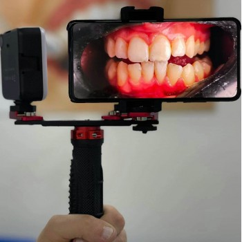 Dental Adjustment Oral Photography Flash Light Mobile Phone Dental Photography F...