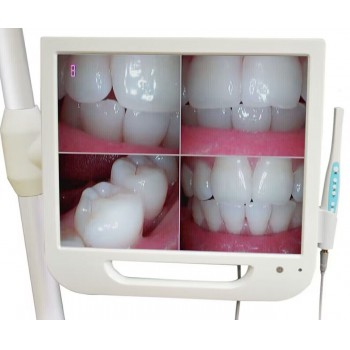 17 Inch High-Definition Digital LCD AIO Monitor Dental Intra oral Camera