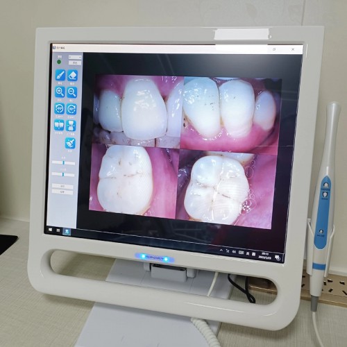 YF-1700P+ 17 Inch Dental Intraoral Camera Touch LCD Screen for Dental Unit with Bracket 6PCS LEDS 8.0 Mega Pixels