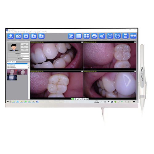 Magenta YF-2400P 24 Inch Touch Screen Intraoral Camera with LCD Monitor & Wifi Function