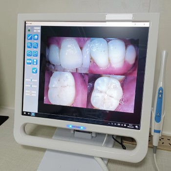 YF-1700P+ 17 Inch Dental Intraoral Camera Touch LCD Screen for Dental Unit with ...
