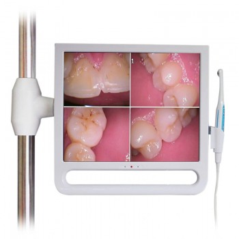 YF1700M 17 Inch Dental Intraoral Camera with Monitor & Bracket Holder 1024*768 Pixels