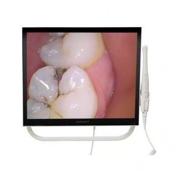 Magenta YFHD-D Dental Intraoral Camera 1/4 sony CCD 17 Inch Monitor & Support Ar...