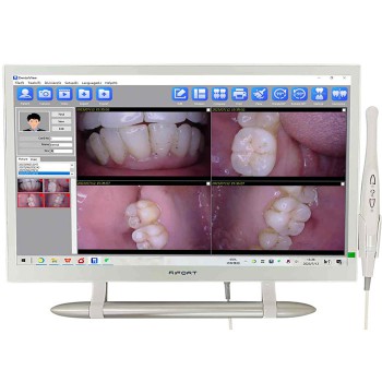 Magenta YF-2200P+ 21.5 Inch LCD Monitor Touch Screen Intraoral Camera VGA+HDMI