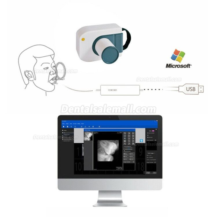 Dental Digital Image RVG X-Ray Sensor Dental Intraoral Imaging System 