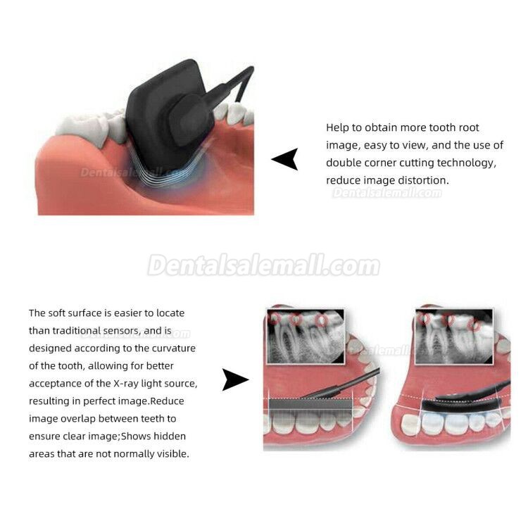 Dental Digital Image RVG X-Ray Sensor Dental Intraoral Imaging System 