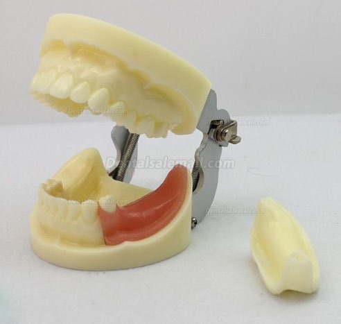 Dental Model With Removable Teeth : Find Many Great New & Used Options And Get The Best Deals For 1X Easyinsmile Dental Teaching Typodont Model Large With Removable Teeth Colgate At The Best Online Prices At Ebay!