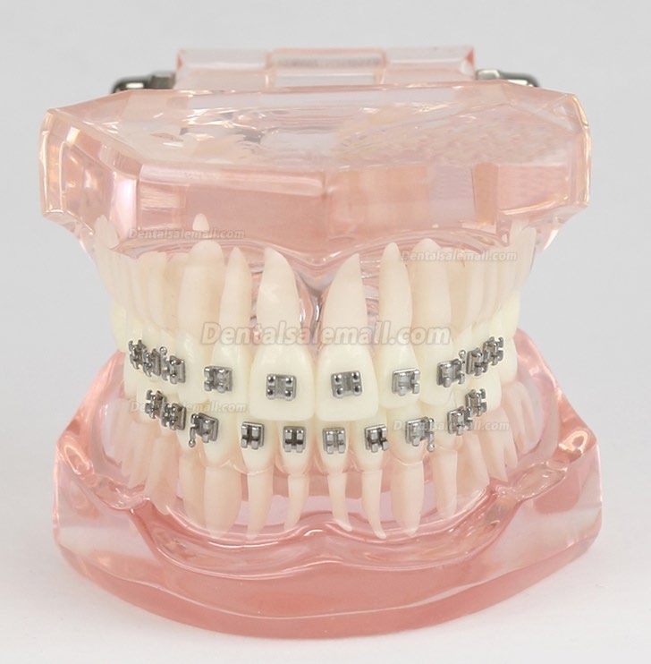 Dental Teeth Malocclusion Correct With Metal Bracket Standard Model M3001