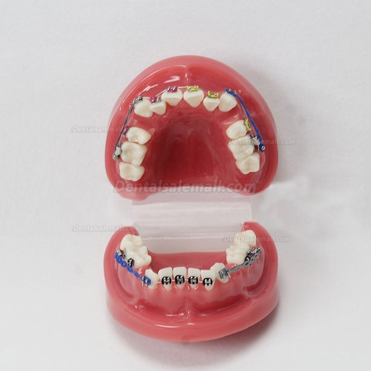 Dental Teeth Malocclusion Correct With Teeth Bracket Standard Model M3005
