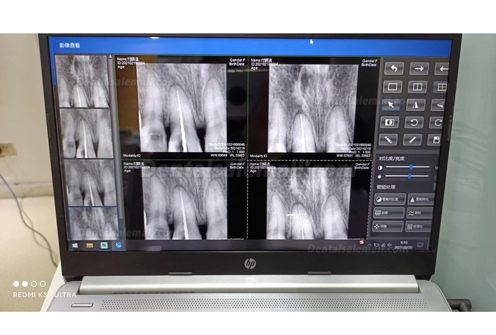 Dental Digital Image RVG X-Ray Sensor Dental Intraoral Imaging System 