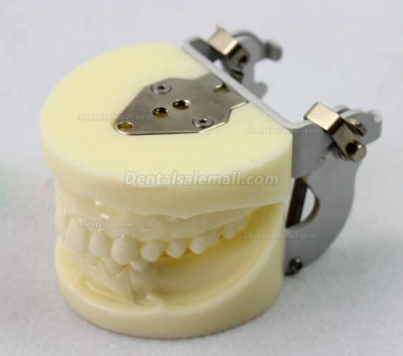 ENOVO Brand Removable Dental Implant Study Model