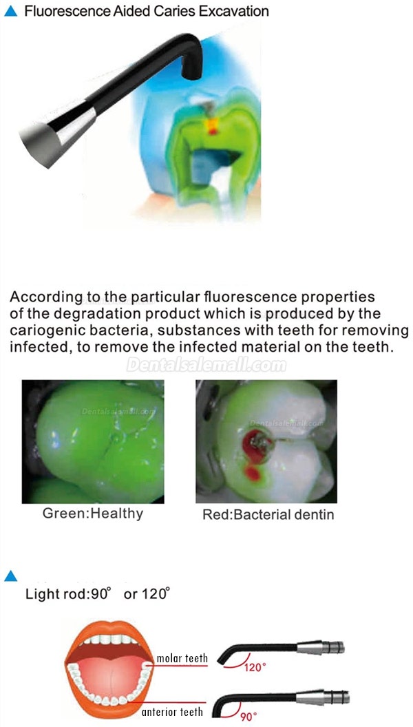 YUSENDENT® COXO C-Hunter Dental Caries Detector