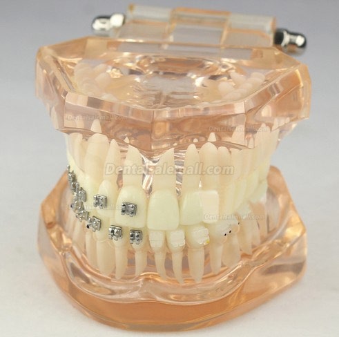 Dental Orthodontic Model with Ceramic Brackets M3009