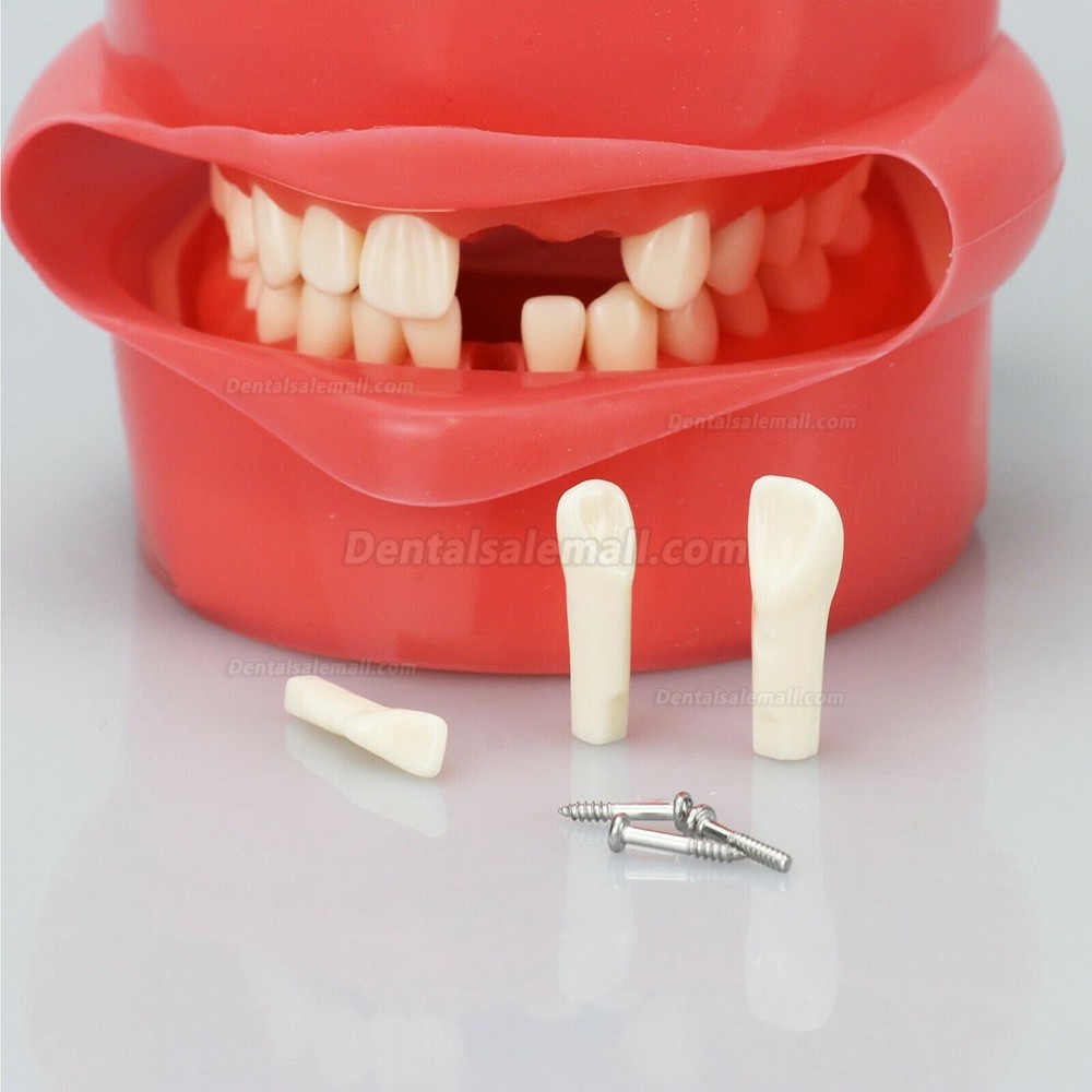 Dental Manual Manikin Simulator Phantom Head Model for Dentist Training Practice Compatible with Nissin Kilgore