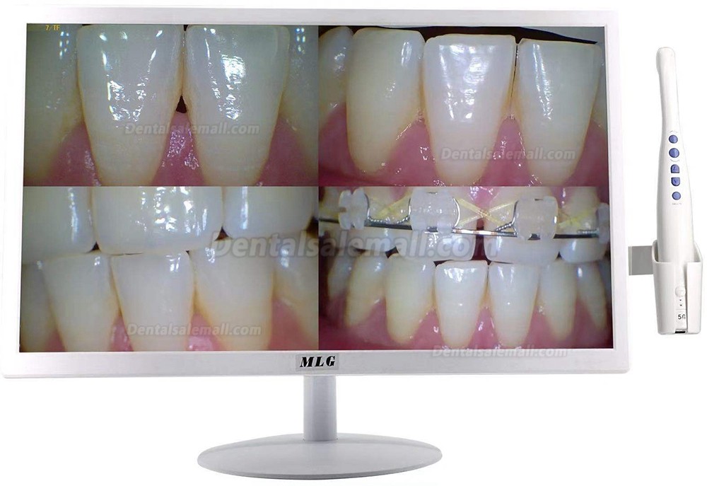 MLG M-978A 19 Inch LCD Monitor with 5G Wireless Wifi 8 Mega Pixels Intraoral Camera for Dental Chair