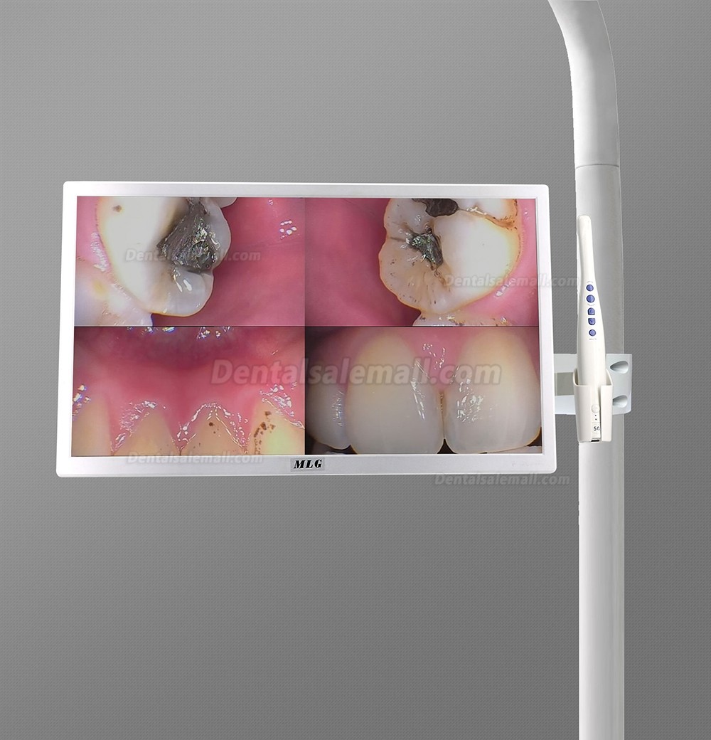 MLG M-978A 19 Inch LCD Monitor with 5G Wireless Wifi 8 Mega Pixels Intraoral Camera for Dental Chair