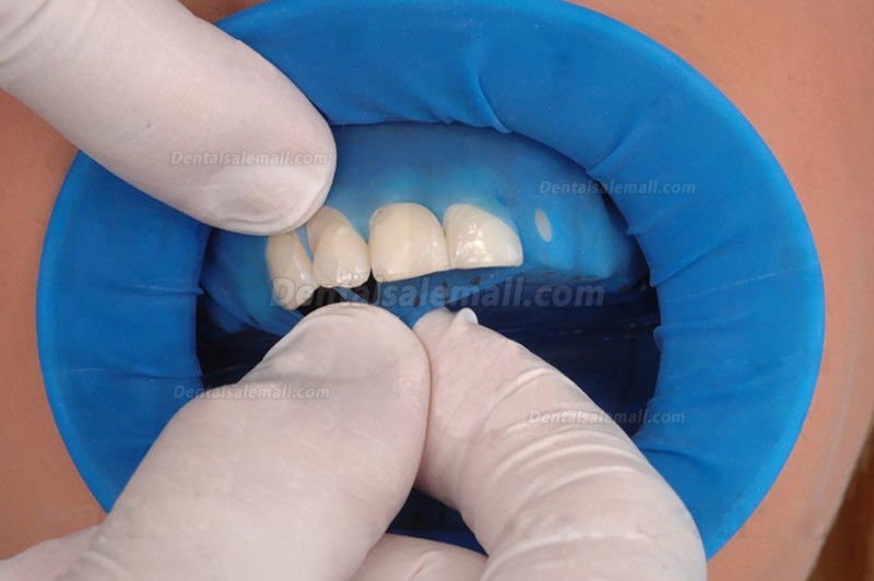 20Pcs Disposable Sterile Rubber Dam Dental Cheek Lip Retractor Opener Latex New