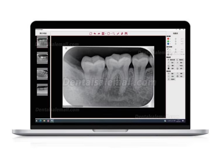 Runyes DS630 PSP Digital Image Plate Scanner X-ray PSP Scanner at ...