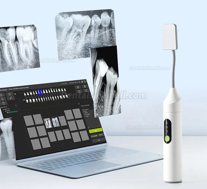 Handheld X-Ray Dental Unit Built-in Screen + Wireless X-Ray Sensor Handheld X-Ray Dental Unit Built-in Screen + Wireless X-Ray Sensor