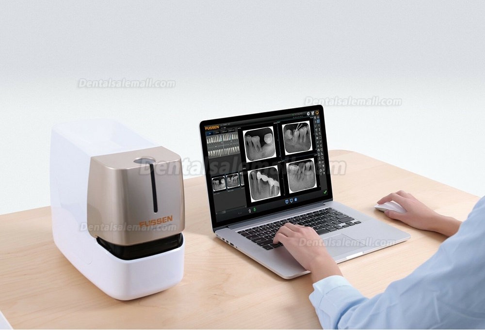 Fussen F200 Dental Phosphor Plate Scanner X Ray Imaging PSP Scanner at ...