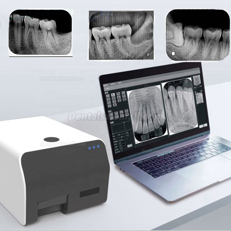 VRN EQ-600 Digital Imaging PSP Scanner Dental Phosphor Plate Scanner System