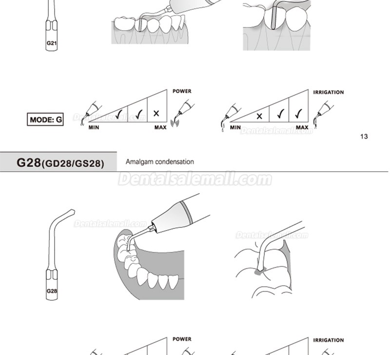 5Pcs G20 G21 G30 G31 G32 G33 G35 Scaling Tips Compatible with REFINE EMS Woodpecker Scaler Handpiece