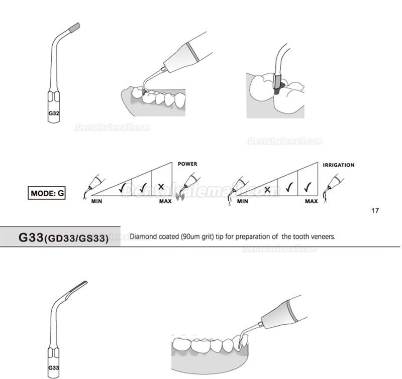 5Pcs G20 G21 G30 G31 G32 G33 G35 Scaling Tips Compatible with REFINE EMS Woodpecker Scaler Handpiece