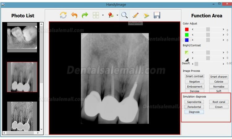 Portable Dental X ray Unit AD-60P + Handy HDR 500 X-ray Sensor