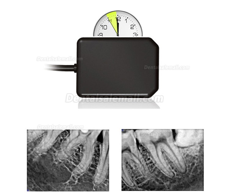 Portable Dental X ray Unit AD-60P + Handy HDR 500 X-ray Sensor