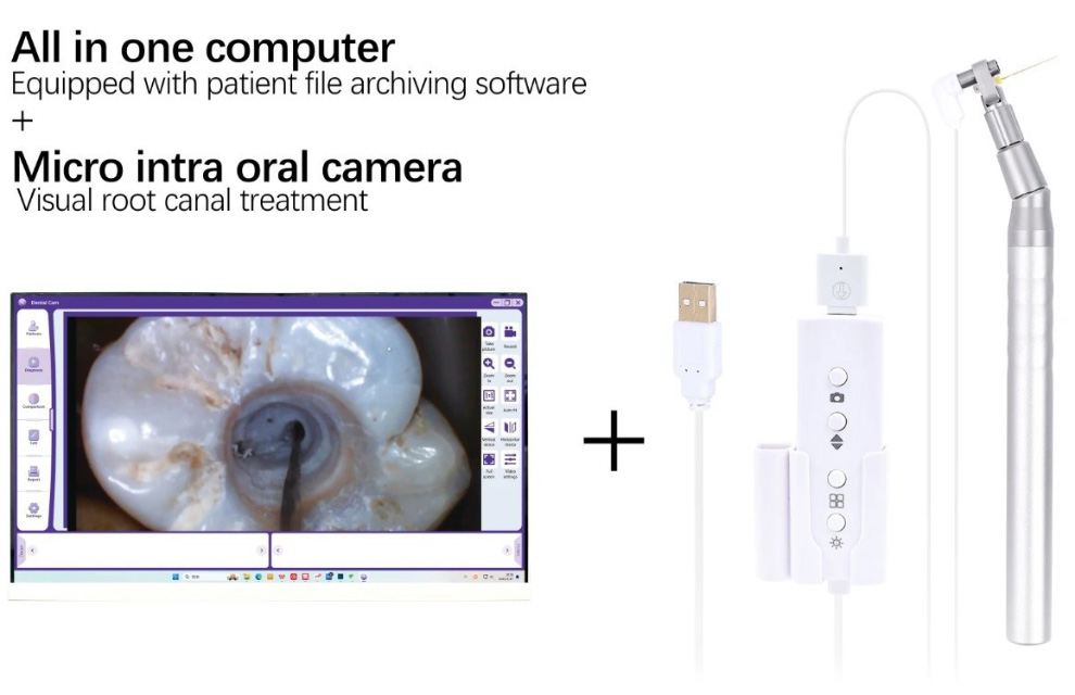 Dental Micro Intraoral Camera for Root Canal Treatment USB-A 1/9-Inch Image Sensor