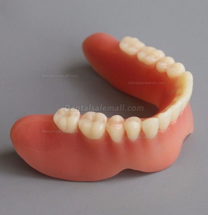 Dental Model #2014 02 - Mandible Implant and Overdenture Demo Model (Yellow)