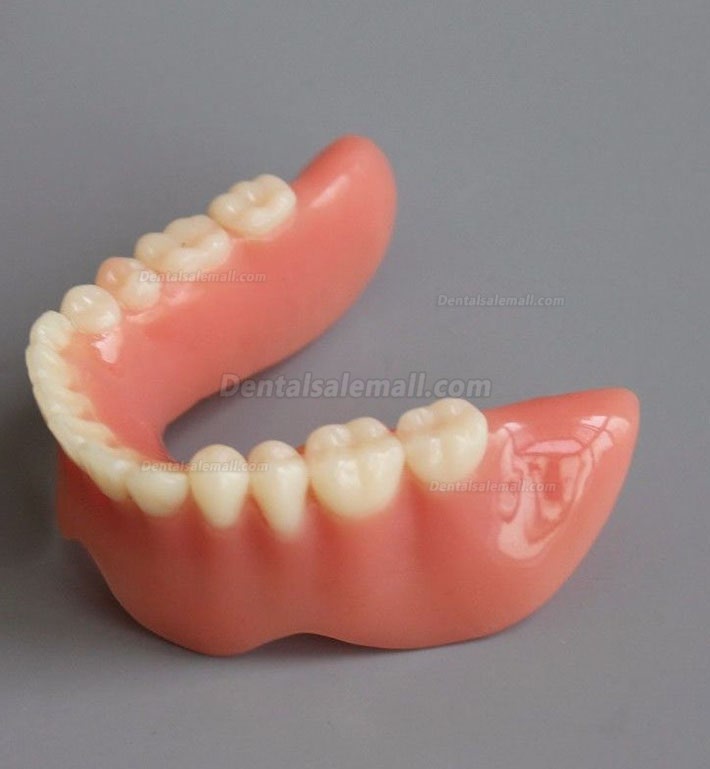 Dental Model #2014 02 - Mandible Implant and Overdenture Demo Model (Yellow)