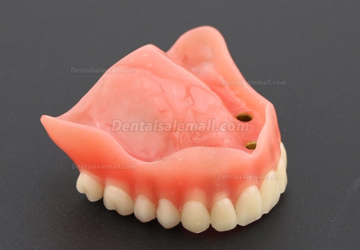 Dental Study Teeth Model Overdenture With 4 Implants Demo Model 6001