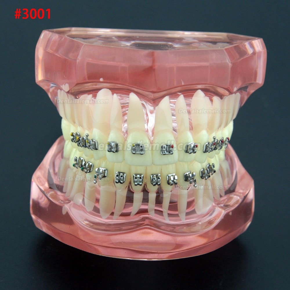 Dental Orthodontic Treatment Demonstration Practice Teeth Model