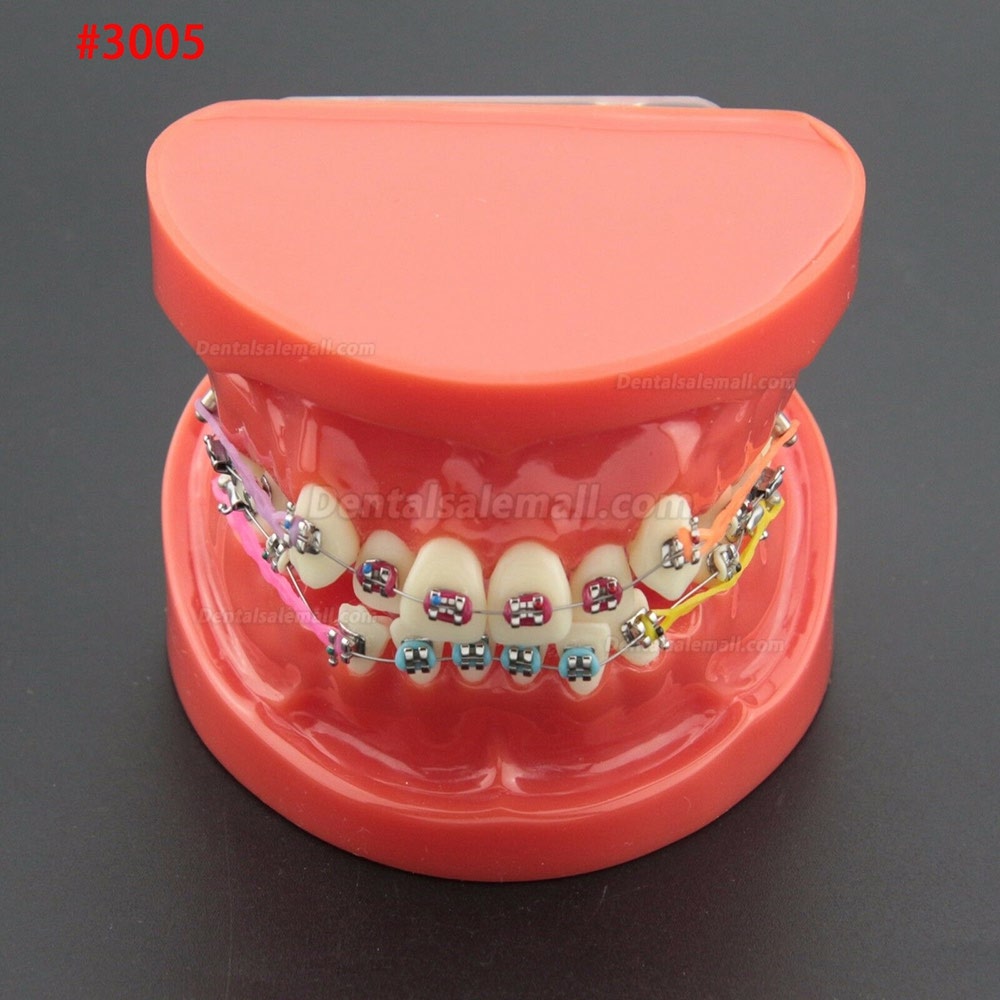 Dental Orthodontic Treatment Demonstration Practice Teeth Model