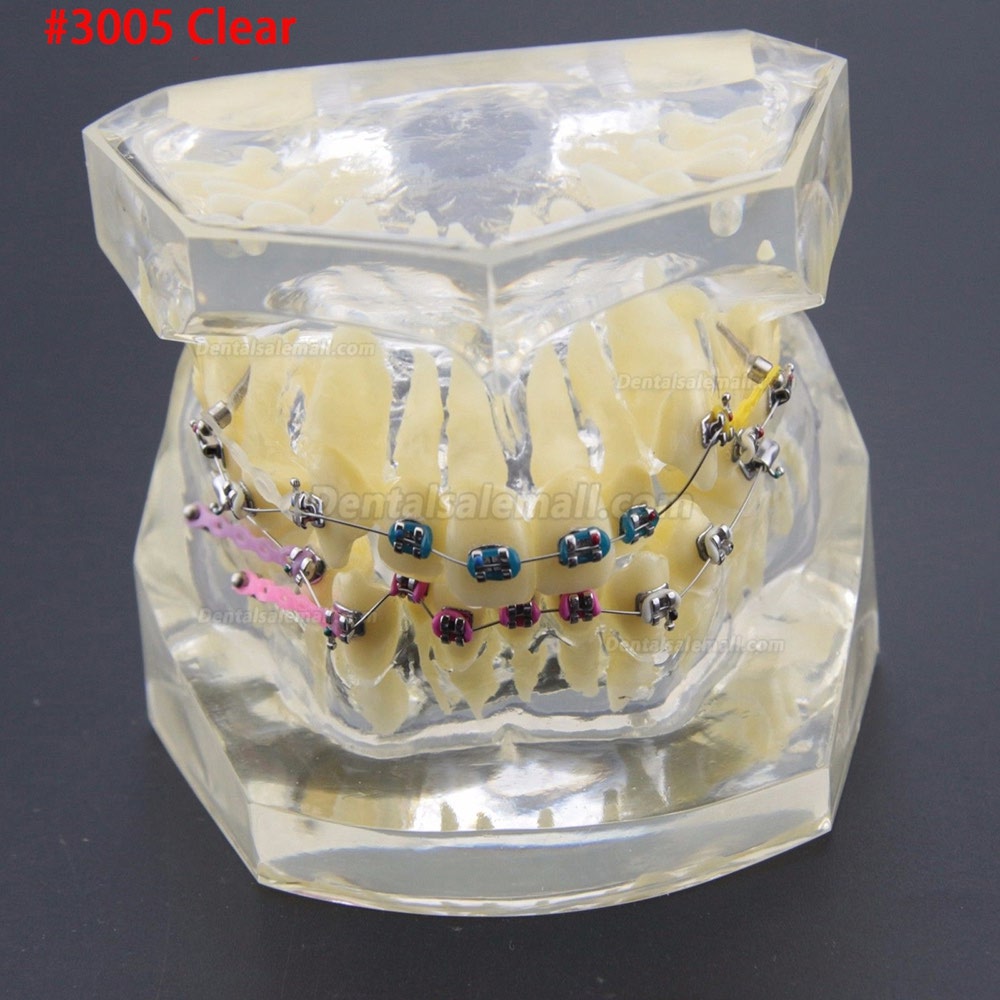 Dental Orthodontic Treatment Demonstration Practice Teeth Model