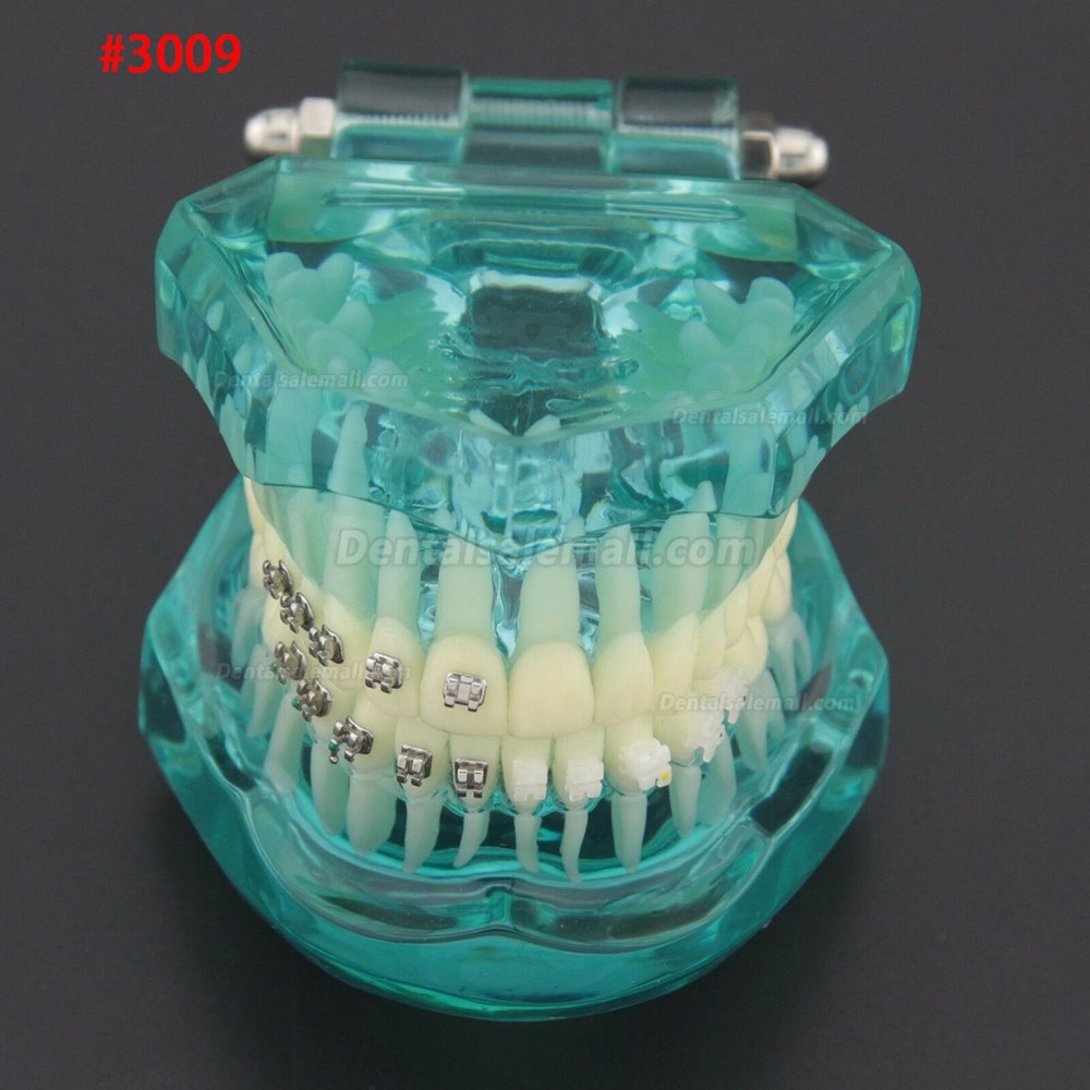 Dental Orthodontic Treatment Demonstration Practice Teeth Model