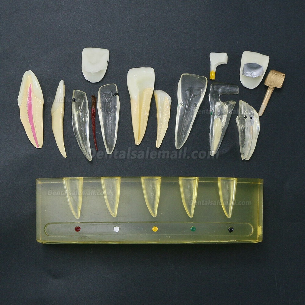 Dental Teeth Model 5 Stages Demonstration Endodontic Treatment Root Canal Incisor