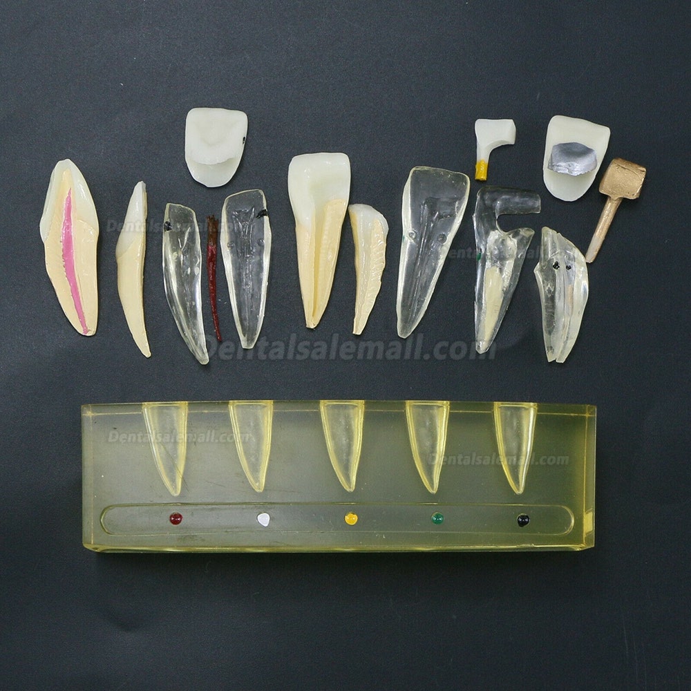 Dental Teeth Model 5Stages Demonstration Endodontic Treatment Root Canal Incisor