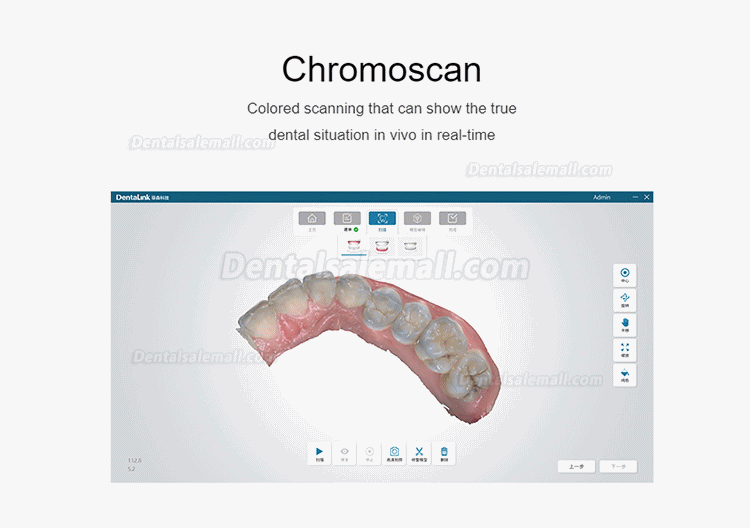 Fussen S6000 Portable Dental 3D Digital Intraoral Scanner Color Scanning 3D