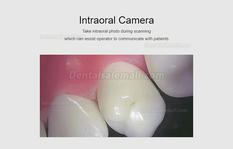 Fussen S6000 Portable Dental 3D Digital Intraoral Scanner Color Scanning 3D High Resolution
