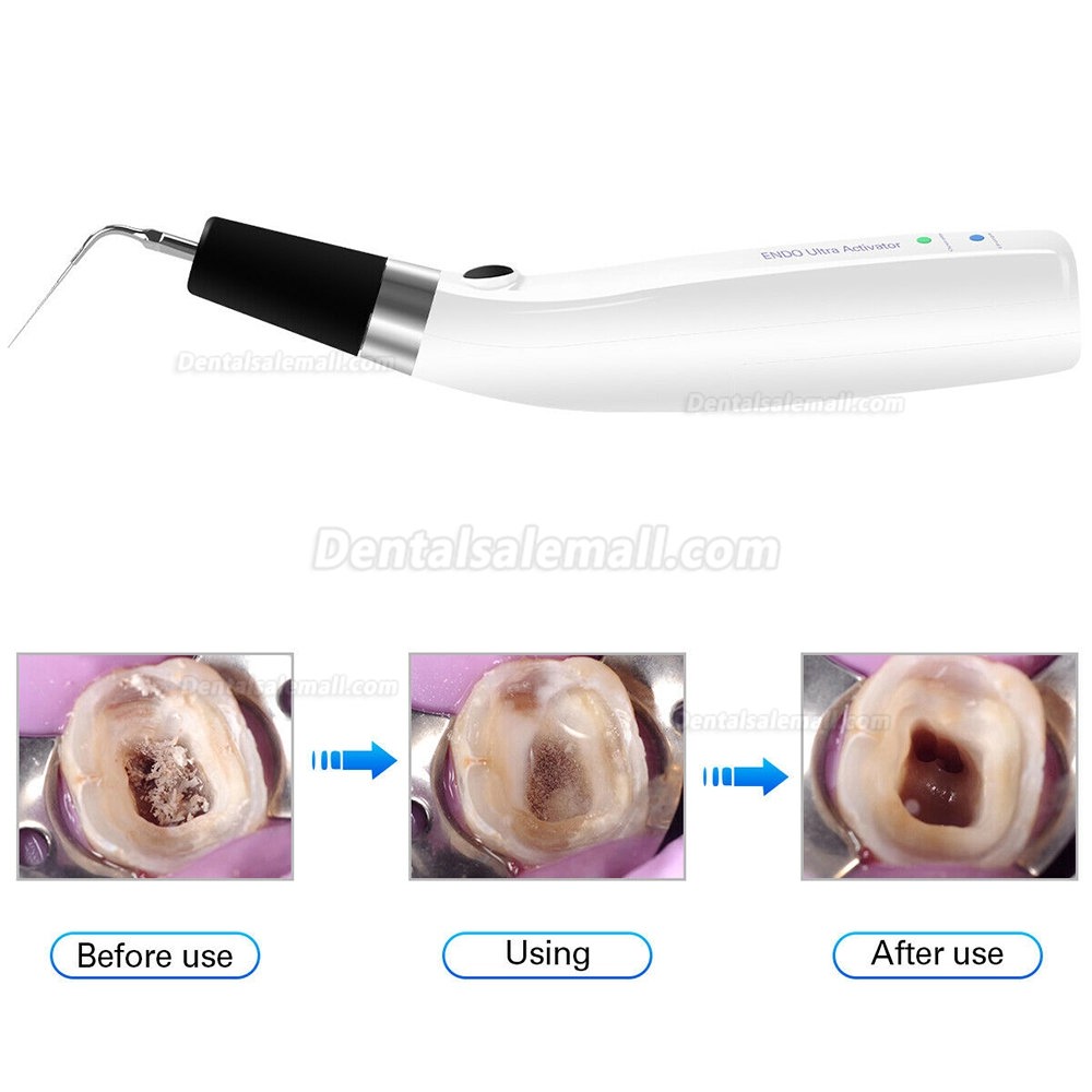 Dental Sonic Endo Irrigator Ultrasonic Endo Ultra Activator Handpiece+6pcs Titanium Tips