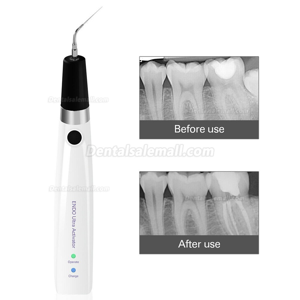 Dental Sonic Endo Irrigator Ultrasonic Endo Ultra Activator Handpiece+6pcs Titanium Tips